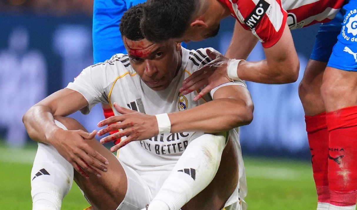 Kontroversi VAR La Liga: Mbappe Berdarah, Real Madrid Desak Rekaman Dibuka